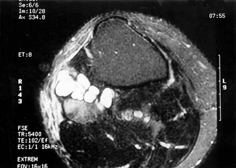 Basic Science Board Review 2002: High-Yield MCQs (Set 2) - Figure 41