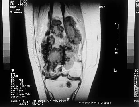 Basic Science Board Review 2002: High-Yield MCQs (Set 2) - Figure 43
