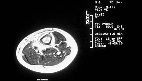 Basic Science Board Review 2002: High-Yield MCQs (Set 2) - Figure 6