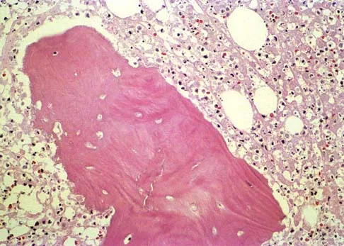 Basic Science Board Review 2002: High-Yield MCQs (Set 2) - Figure 9