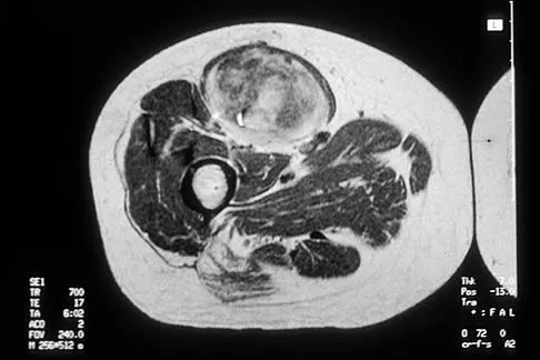 Basic Science 2002 Practice Questions: Set 3 (Solved) - Figure 13