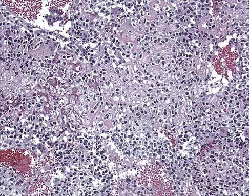Basic Science 2002 Practice Questions: Set 3 (Solved) - Figure 16