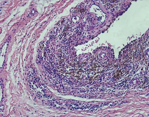 Basic Science 2002 Practice Questions: Set 3 (Solved) - Figure 29