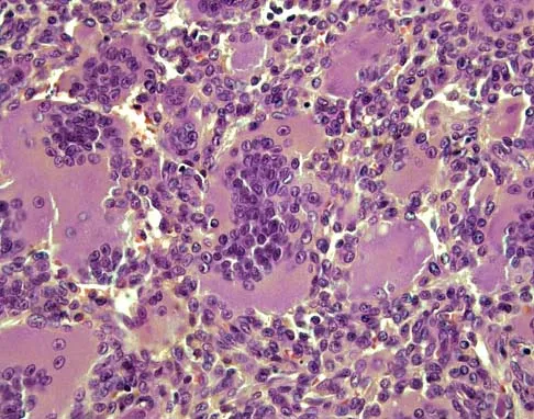Basic Science 2002 Practice Questions: Set 3 (Solved) - Figure 5