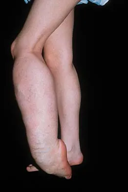 Basic Science 2002 Practice Questions: Set 3 (Solved) - Figure 9