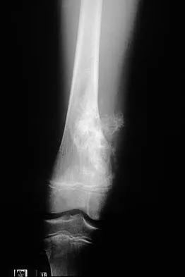 Basic Science Board Review 2002: High-Yield MCQs (Set 4) - Figure 13