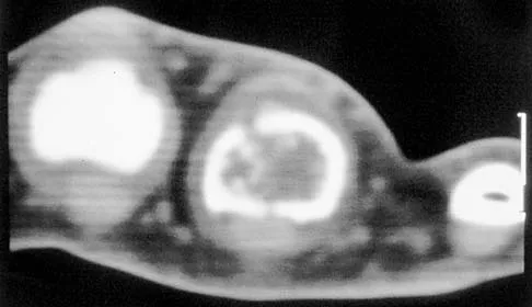 Basic Science Board Review 2002: High-Yield MCQs (Set 4) - Figure 2