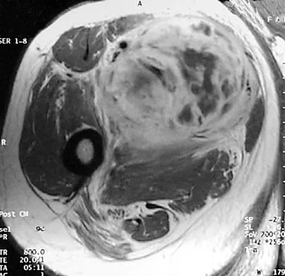 Basic Science Board Review 2002: High-Yield MCQs (Set 4) - Figure 20