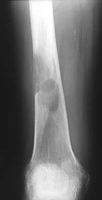 Basic Science Board Review 2002: High-Yield MCQs (Set 4) - Figure 21