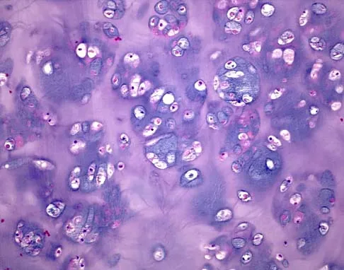 Basic Science Board Review 2002: High-Yield MCQs (Set 4) - Figure 3