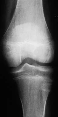 Basic Science Board Review 2002: High-Yield MCQs (Set 4) - Figure 5