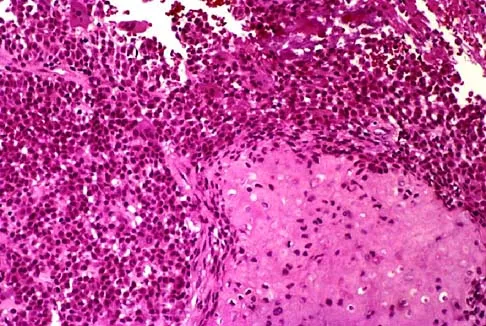 Basic Science Board Review 2002: High-Yield MCQs (Set 4) - Figure 8