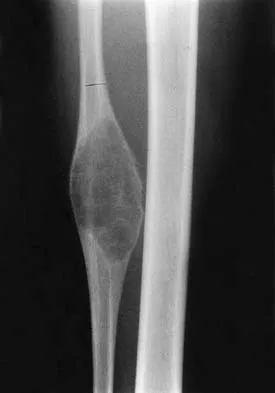 AAOS Basic Science MCQs (Set 1): Bone Physiology, Biomechanics & Pharmacology | Ortho Board Review