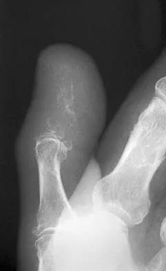 Basic Science 2005 Practice Questions: Set 1 (Solved) - Figure 27