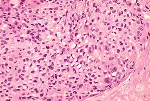 Basic Science 2005 Practice Questions: Set 1 (Solved) - Figure 29