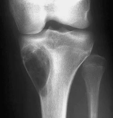 Basic Science 2005 Practice Questions: Set 1 (Solved) - Figure 30