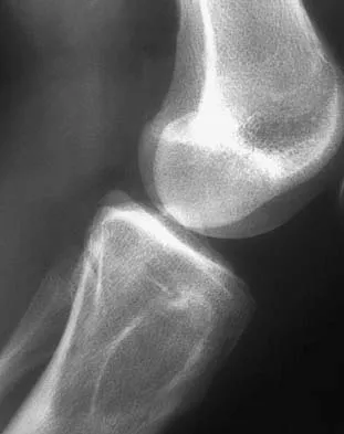 Basic Science 2005 Practice Questions: Set 1 (Solved) - Figure 31
