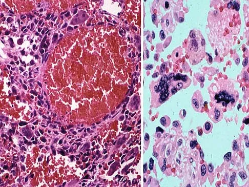 Basic Science 2005 Practice Questions: Set 1 (Solved) - Figure 33