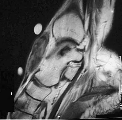 Basic Science 2005 Practice Questions: Set 1 (Solved) - Figure 38