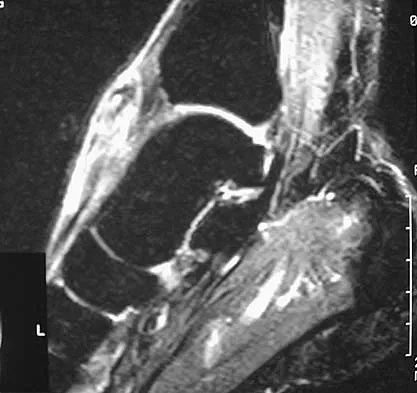 Basic Science 2005 Practice Questions: Set 1 (Solved) - Figure 39