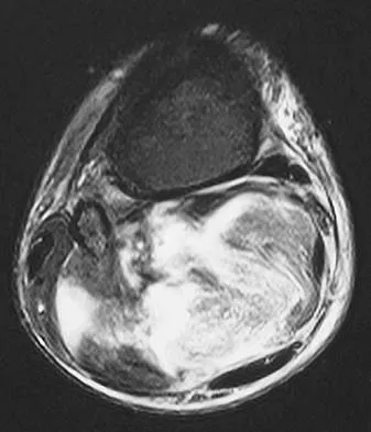 Basic Science 2005 Practice Questions: Set 1 (Solved) - Figure 44