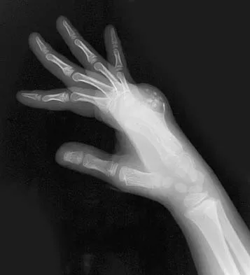 Click to enlarge Basic Science 2005 Practice Questions: Set 1 (Solved) - Figure 51