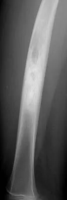 Basic Science 2005 Practice Questions: Set 1 (Solved) - Figure 8