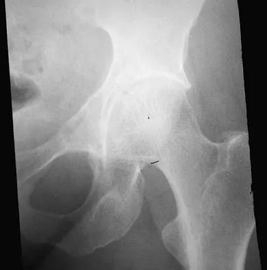 Basic Science Board Review 2005: High-Yield MCQs (Set 2) - Figure 2