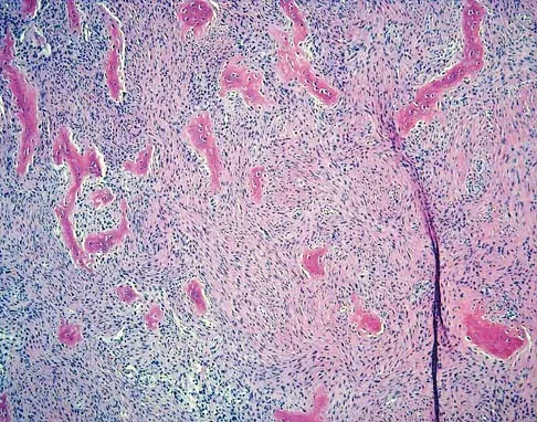 Basic Science Board Review 2005: High-Yield MCQs (Set 2) - Figure 21
