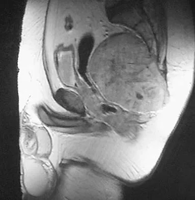 Basic Science Board Review 2005: High-Yield MCQs (Set 2) - Figure 31