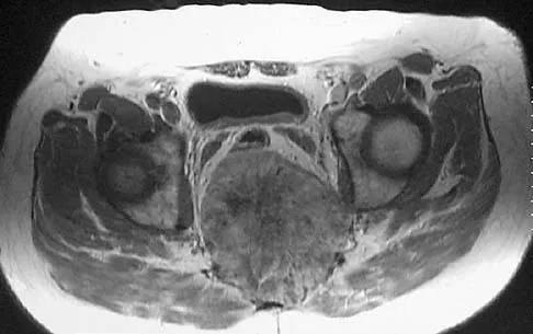 Basic Science Board Review 2005: High-Yield MCQs (Set 2) - Figure 32