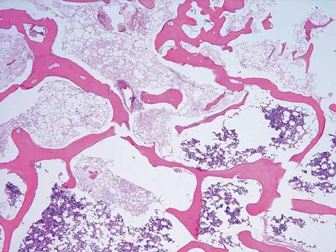 Basic Science Board Review 2005: High-Yield MCQs (Set 2) - Figure 34