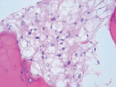 Basic Science Board Review 2005: High-Yield MCQs (Set 2) - Figure 35