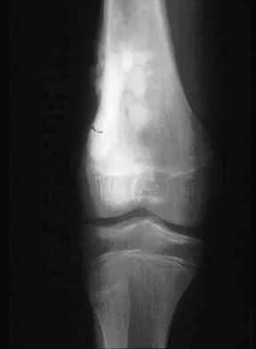 Basic Science Board Review 2005: High-Yield MCQs (Set 2) - Figure 36