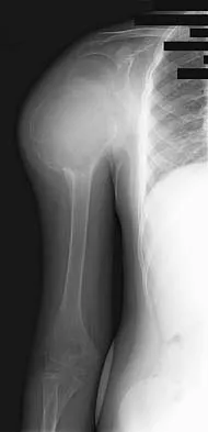 Basic Science Board Review 2005: High-Yield MCQs (Set 2) - Figure 44