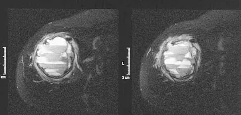 Basic Science Board Review 2005: High-Yield MCQs (Set 2) - Figure 45