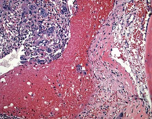Basic Science Board Review 2005: High-Yield MCQs (Set 2) - Figure 47