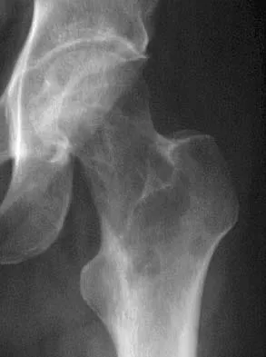 Basic Science Board Review 2005: High-Yield MCQs (Set 2) - Figure 48