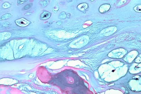 Basic Science Board Review 2005: High-Yield MCQs (Set 2) - Figure 6