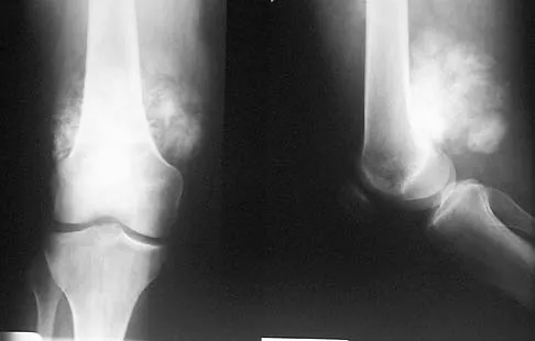 Basic Science 2005 Practice Questions: Set 3 (Solved) - Figure 13