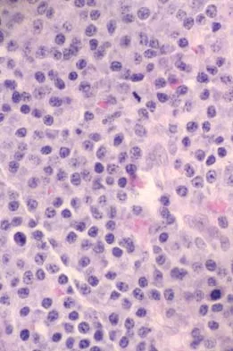 Basic Science 2005 Practice Questions: Set 3 (Solved) - Figure 30