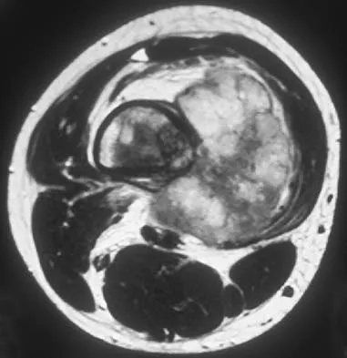 Basic Science 2005 Practice Questions: Set 3 (Solved) - Figure 32