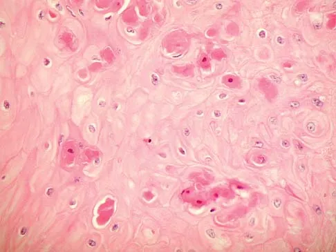 Basic Science 2005 Practice Questions: Set 3 (Solved) - Figure 34