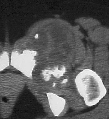 Basic Science 2005 Practice Questions: Set 3 (Solved) - Figure 38