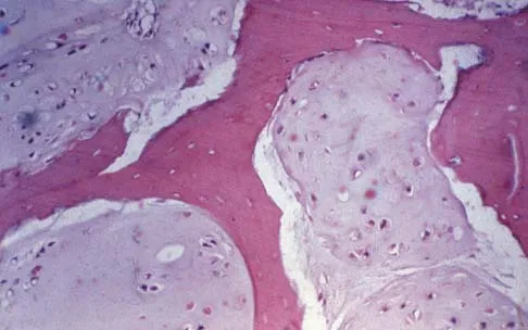 Basic Science 2005 Practice Questions: Set 3 (Solved) - Figure 39