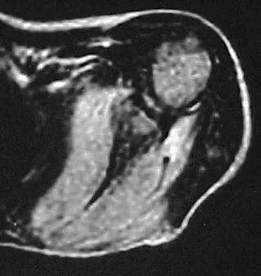 Basic Science 2005 Practice Questions: Set 3 (Solved) - Figure 6