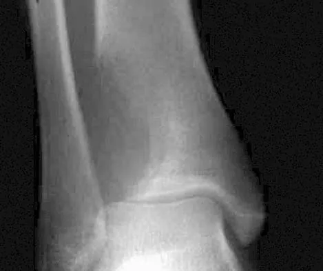 AAOS & ABOS Basic Science MCQs (Set 4): Bone Biology, Biomechanics & Physiology | Orthopedic Board Prep