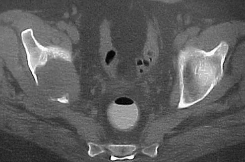Basic Science Board Review 2005: High-Yield MCQs (Set 4) - Figure 11