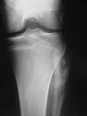 Basic Science Board Review 2005: High-Yield MCQs (Set 4) - Figure 12