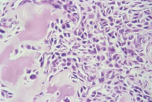 Basic Science Board Review 2005: High-Yield MCQs (Set 4) - Figure 15